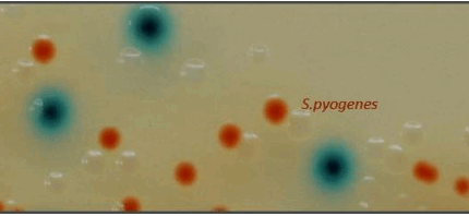 CHROMagar Strep A BIOPREPARE Τρυβλίο 90 mm