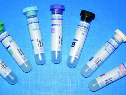 Σωληνάρια TAPVAL πλαστικά με 3K EDTA, για 1ml αίμα, για γενική αίματος.