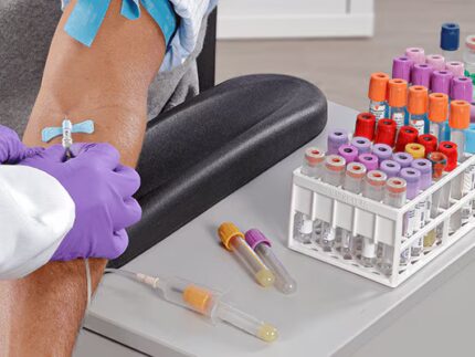 Σωληνάρια Υπό Κενό Vacutainer BD (100τεμ.)